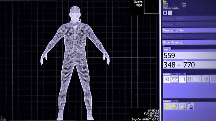 Computer-Screen mit Wireframe-Mann