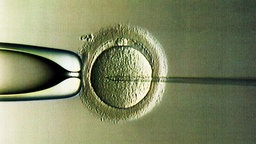 Intra-Cytoplasmatische Sperma-Injektion (ICSI) in der Universitäts-Frauenklinik in Heidelberg