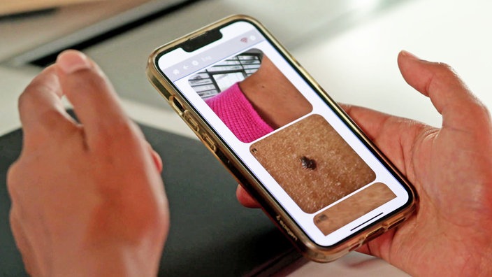 Früherkennungs-App auf einem Smartphone