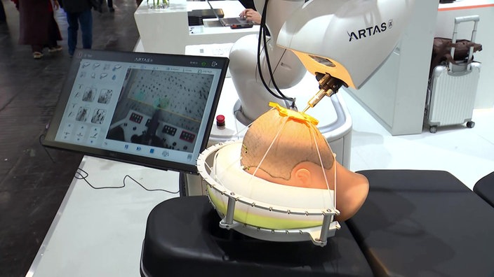 Haartransplantation mittels Roboter