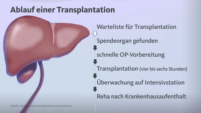 Ablauf einer Lebertransplantation