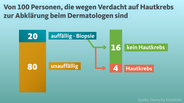 Verdacht auf Hautkrebs