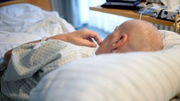 Patientin mit kahlem Kopf im Bett einer Palliativstation