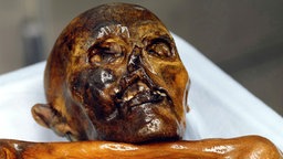 "Ötzi"