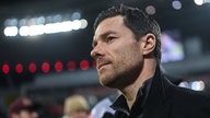 Bayer-Trainer Xabi Alonso macht das Remis gegen Gladbach im Kampf um den Titel nicht nervös.